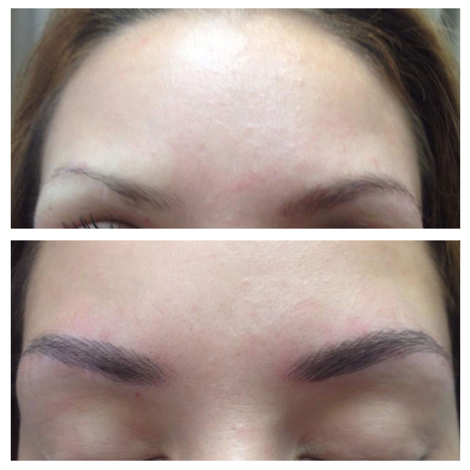 thecarousel-eyebrow-before-after4