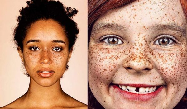 Freckle Portraits Will Blow You Away