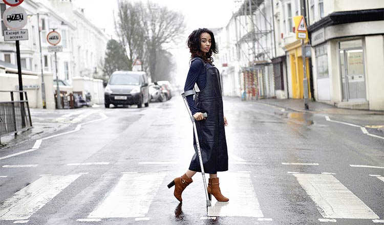 Meet The Inspiring Model With The Bionic Leg