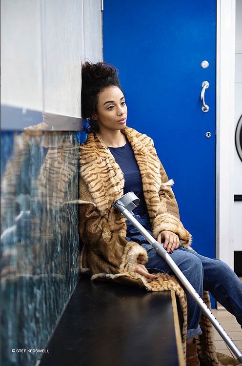 Meet The Inspiring Model With The Bionic Leg