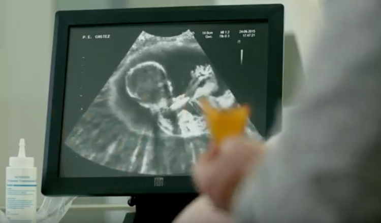 Aussie Filmmaker’s $2000 Ultrasound Super Bowl Ad